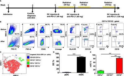 Case Report: In Situ Vaccination by Autologous CD16+ Dendritic Cells and Anti-PD-L 1 Antibody Synergized With Radiotherapy To Boost T Cells-Mediated Antitumor Efficacy In A Psoriatic Patient With Cutaneous Squamous Cell Carcinoma